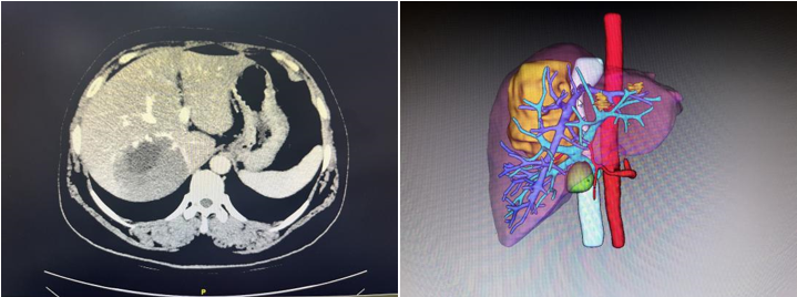 f2ae280e98463e931c9f4596abb9b09